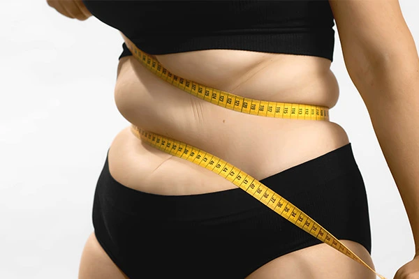 Weight loss surgery is often considered when dieting and exercise alone fall short.