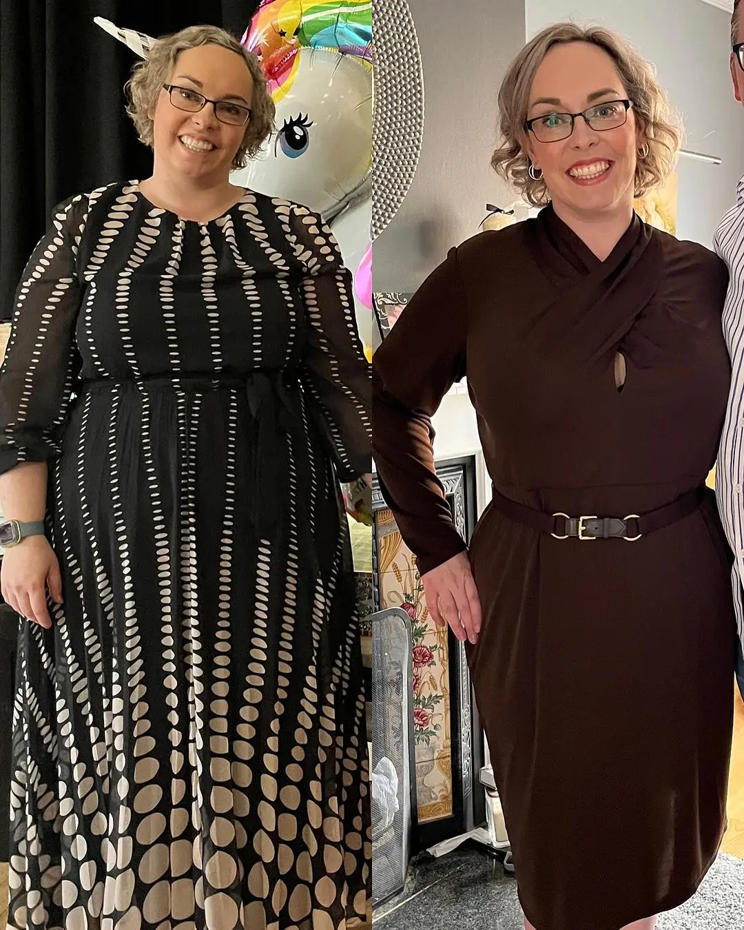 Susan before and after weigh loss