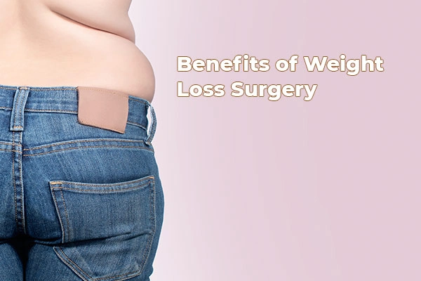 Benefits of Weight Loss Surgery