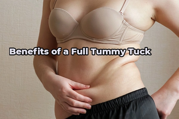 Benefits of a Full Tummy Tuck