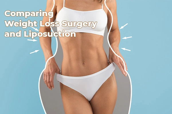 Comparing Weight Loss Surgery and Liposuction