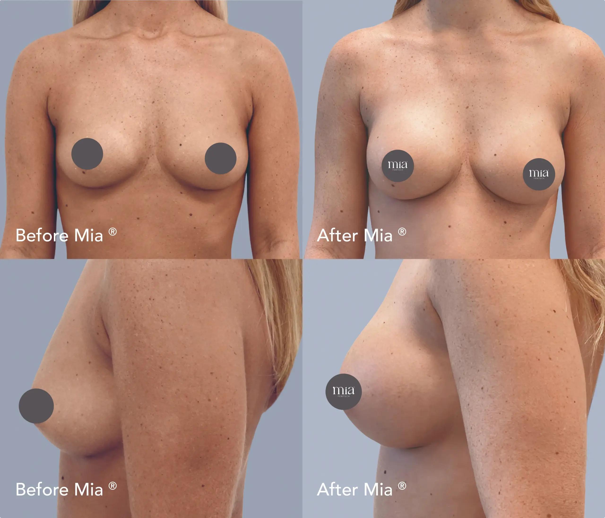 Naomi before and after