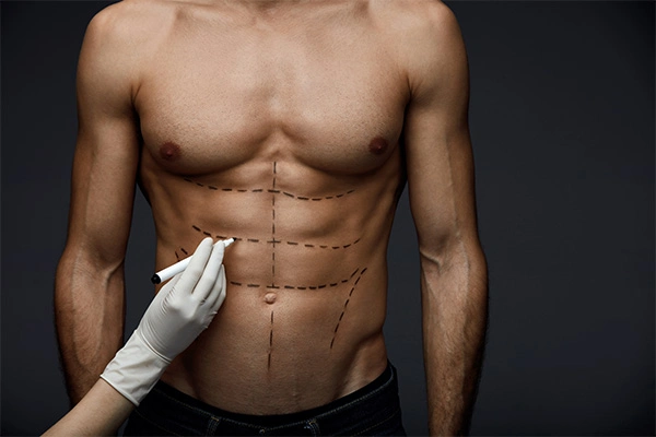 The Most Popular Cosmetic Surgery Procedures In Ireland For 2022