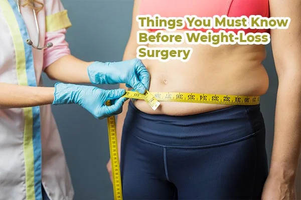 Things You Must Know Before Weight-Loss Surgery