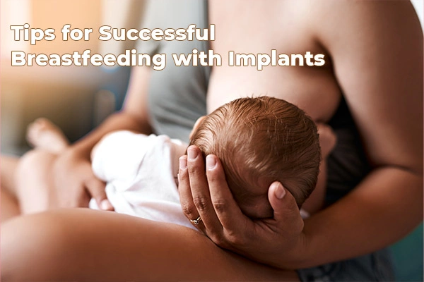 Tips for Successful Breastfeeding with Implants