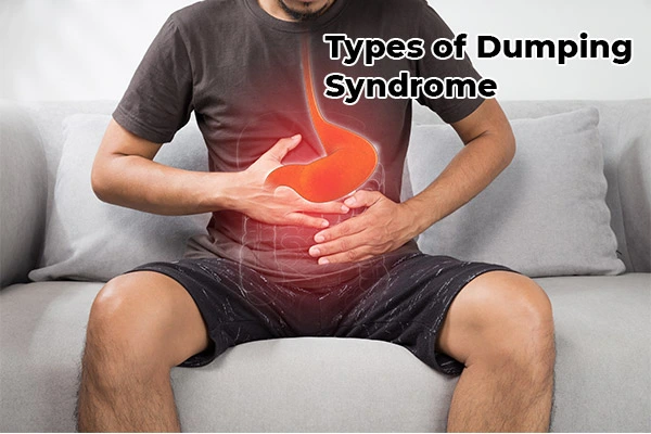 Types of Dumping Syndrome