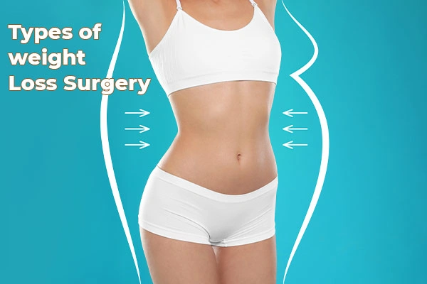 Types of Weight Loss Surgery