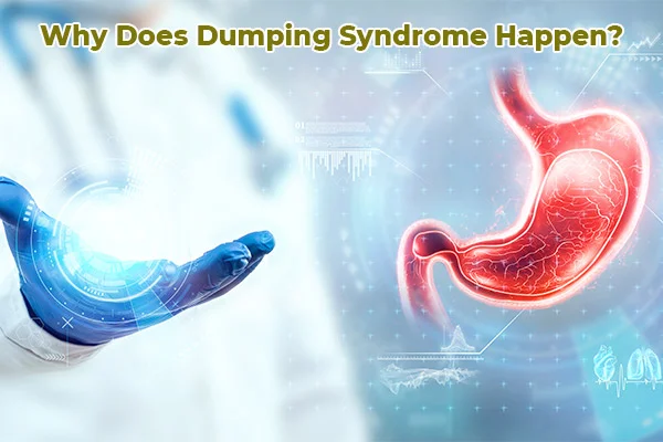 Why Does Dumping Syndrome Happen? 